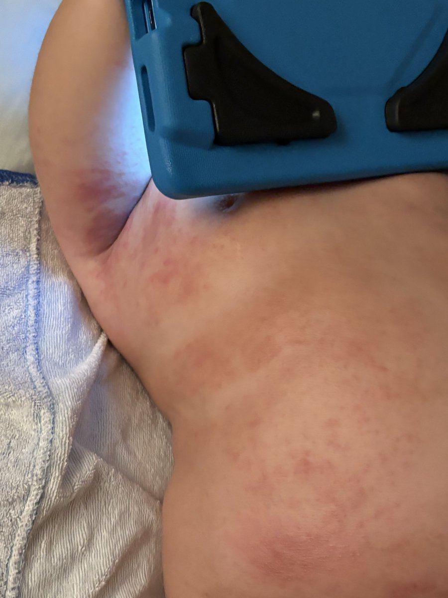 mirandais2's tweet photo. @grok what is it? https://t.co/94zCbg95Qv