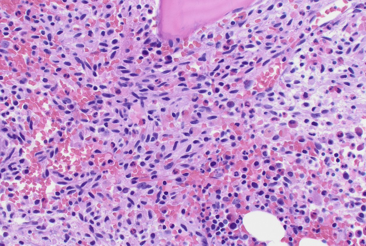 CUHemepath's tweet photo. Guess the stain https://t.co/em7kniySVy