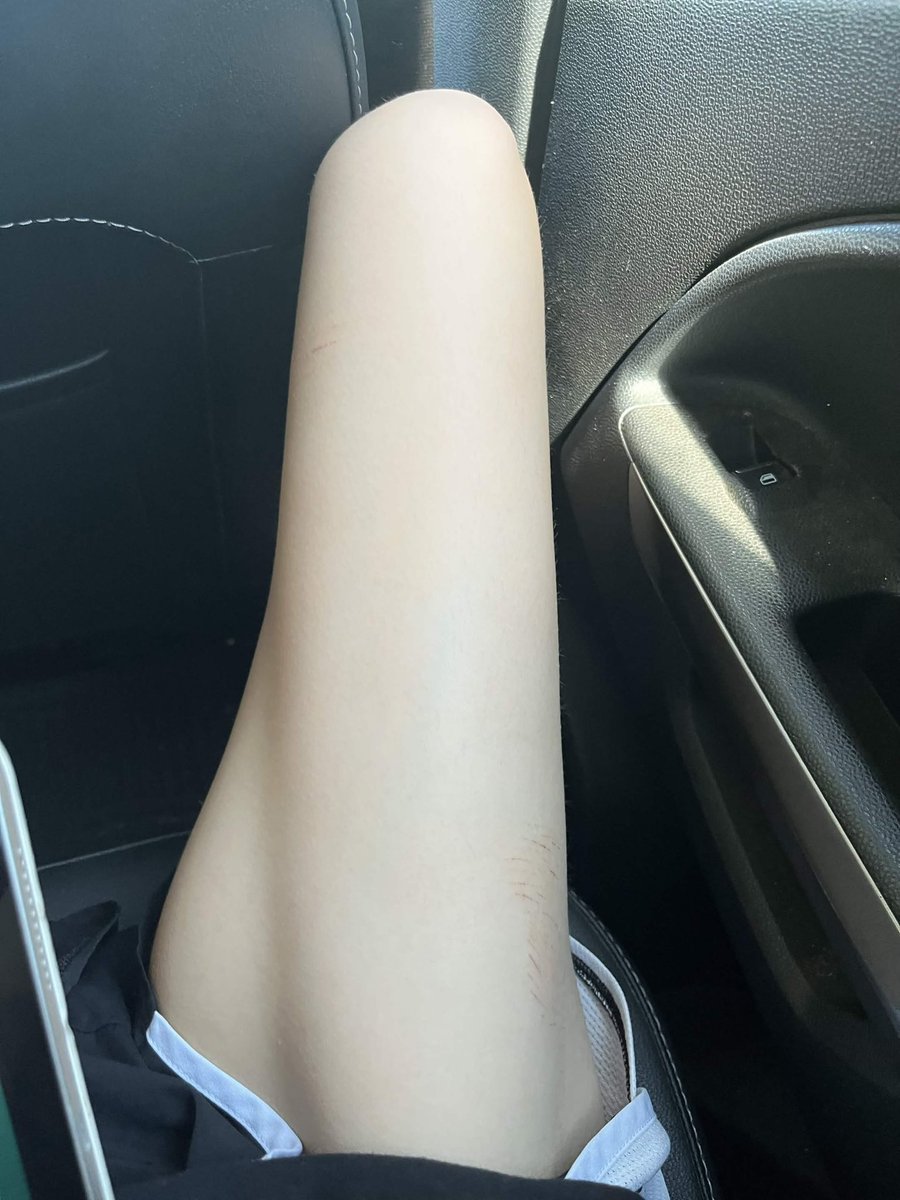KangelAlt's tweet photo. I wish I could just cut this part off https://t.co/RscKNKdteT