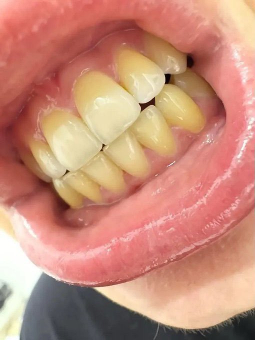 Zevora tweet media