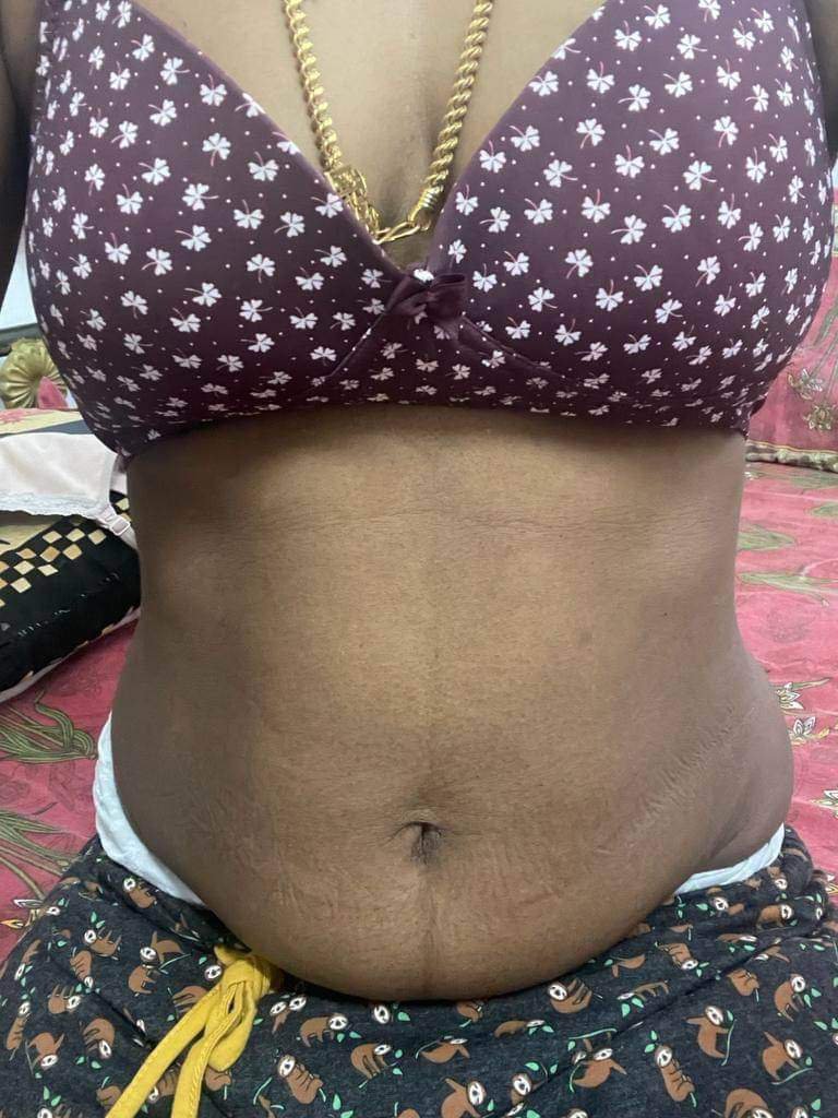 PARVATHI8777's tweet photo. Repost panitu dm va pasalam 😜 https://t.co/02p4uACfOJ
