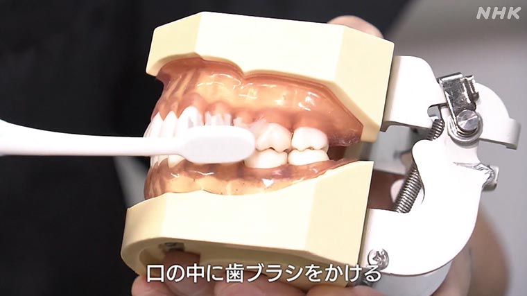 nhk_ikiruskill's tweet photo. 避難生活で歯磨きや入れ歯の洗浄ができないと口の中の細菌が増えて「誤えん性肺炎」になるリスクがあります

断水していても少ない水で歯を磨く方法 ぜひ参考にしてみてください

👇記事で詳しく
https://t.co/b0IlvkSNAQ https://t.co/qRSBeT5OOT