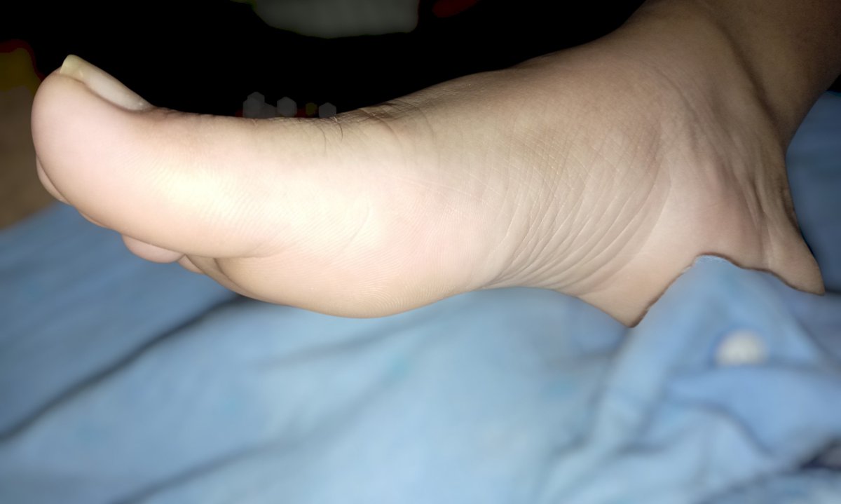 carminafeet12's tweet photo. Unos pisotones a mi Paparazzi y a dormir 🤭🥰👣 #pies #piessudados #olor #oloraqueso #piesudados #dedos #dedogordo #deditos #footfetısh #feetfetısh #natural #foot #closeup #soles #plantadelospies #plantas #arrugas #dedosapretados #fetiche #fetichedepies #uñas https://t.co/51xJO7B3ZQ
