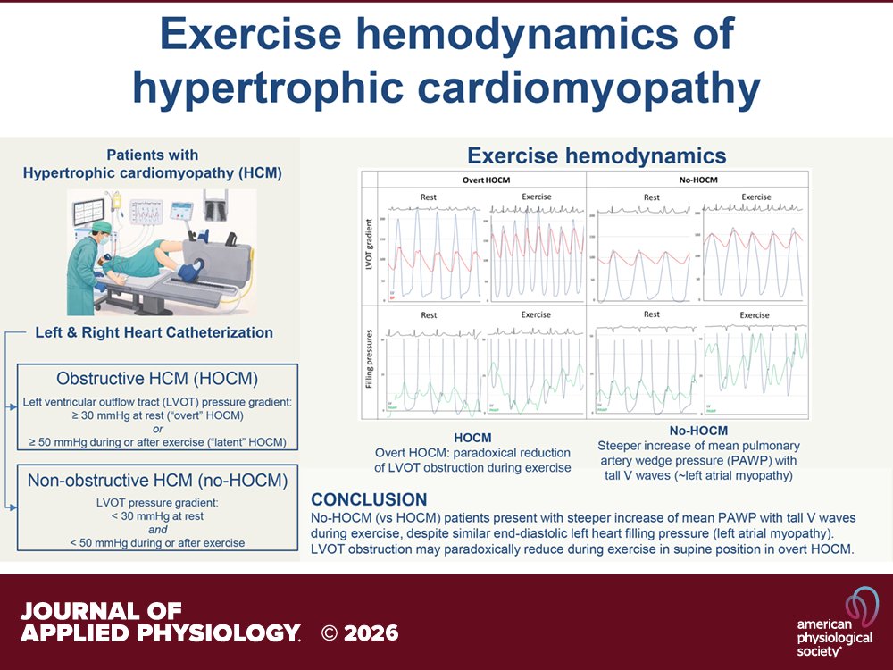 japplphysiol's tweet photo. Research Article by C Baratto et al. (@GParati22 @CaravitaSergio) Invasive #exercise #hemodynamics in obstructive and nonobstructive hypertrophic #cardiomyopathy
https://t.co/g4xJHrVJ4j https://t.co/ZR5jGiOmno