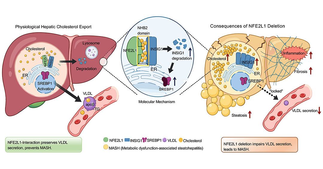 jclinicalinvest's tweet photo. A highlight💫  from earlier this week: How does the ER cope with cholesterol overload?
https://t.co/rpTOQGH7on
Here, Gökhan S. Hotamışlıgil & team @harvardmed identify the NFE2L1/INSIG1 axis that regulates an ER-nuclear transcription factor important to lipid biosynthesis and VLDL secretion. The protein partnership helps prevent cholesterol buildup and liver damage, revealing a potential target for treating fatty liver disease and related metabolic disorders.

The image shows COS7 cells expressing NFE2L1 N term deletion construct; labeled for HA (NFE2L1, red), the ER marker KDEL (blue), and Hoechst nuclear dye. 
#MASH #LiverDisease