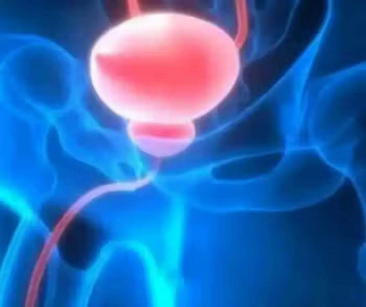 Dx_imaging's tweet photo. FDA Expands Approval of Pluvicto in Combination with ARPI for #PSMA Positive mAPMN/S #ProstateCancer
https://t.co/WHhobT0qsF
@RadiologyACR @ARRS_Radiology @RSNA @SNM_MI @Novartis @SocietyAbdRad @PCFnews
#radiology #RadRes https://t.co/X0FSuODb7x