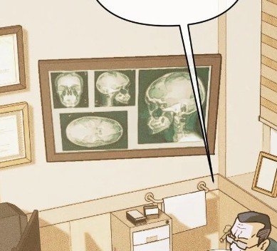 saiisue's tweet photo. If my translation is correct, the doctor says, "Everything that looks white is metal" but that's not entirely true. Not everything white on a radiograph is metal, bone also appears white (radiodense). It almost sounds like he's saying Yuta's entire head is made of metal lmao😭😂 
#조개소년발화 #IgniteTheDawn