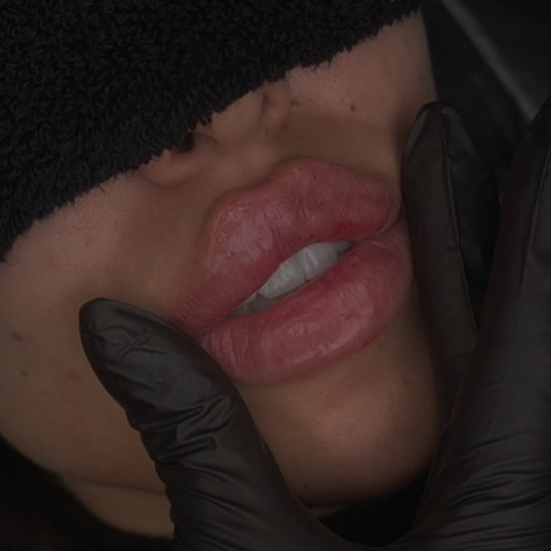 dr_laracheajfuc's tweet photo. Lips... https://t.co/CvJpNCWGS0