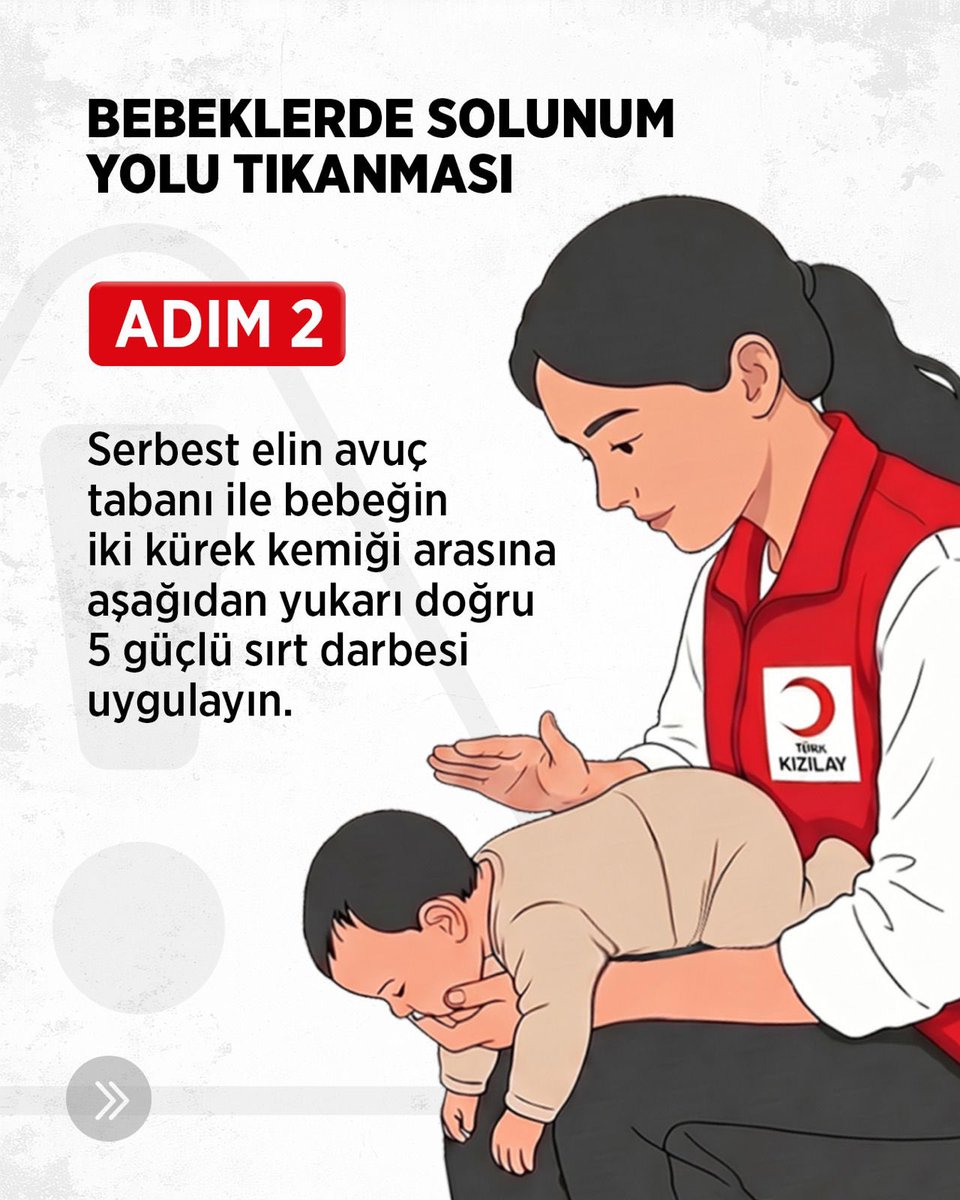 Kizilay's tweet photo. Bir an, bir doğru müdahale, bir hayat... ❤️

Bebeklerde solunum yolu tıkanması saniyeler içinde hayati bir duruma dönüşebilir. Böyle anlarda doğru ilk yardım uygulamalarını bilmek, hayat kurtaran en önemli adımlardan biridir.

İlk yardım bilgisi, acil durumlarda en büyük gücünüzdür. Hazırlıklı olmak için kaydırın, doğru müdahale adımlarını öğrenin. 🚑👶