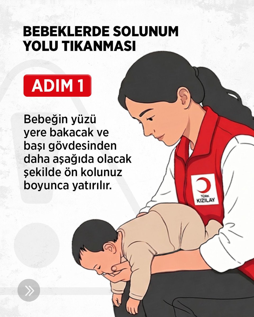 Kizilay's tweet photo. Bir an, bir doğru müdahale, bir hayat... ❤️

Bebeklerde solunum yolu tıkanması saniyeler içinde hayati bir duruma dönüşebilir. Böyle anlarda doğru ilk yardım uygulamalarını bilmek, hayat kurtaran en önemli adımlardan biridir.

İlk yardım bilgisi, acil durumlarda en büyük gücünüzdür. Hazırlıklı olmak için kaydırın, doğru müdahale adımlarını öğrenin. 🚑👶