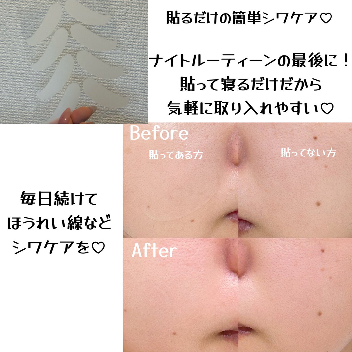 chamcham_101_'s tweet photo. [ #PR] #23時のほうれい線ケア ♡

レチナールほうれい線パッチ🌱

気になるシワを集中ケア♡貼って寝るだけでケアできるから普段のスキンケアルーティンに取り入れやすい💖寝てる間もズレたり取れたりしなかったのが嬉しいポイントだったദ്ദി ˃ ᵕ ˂ )
#ほうれい線ケア #口元ケア #シワ対策  #onslo https://t.co/ibl4rWnI05