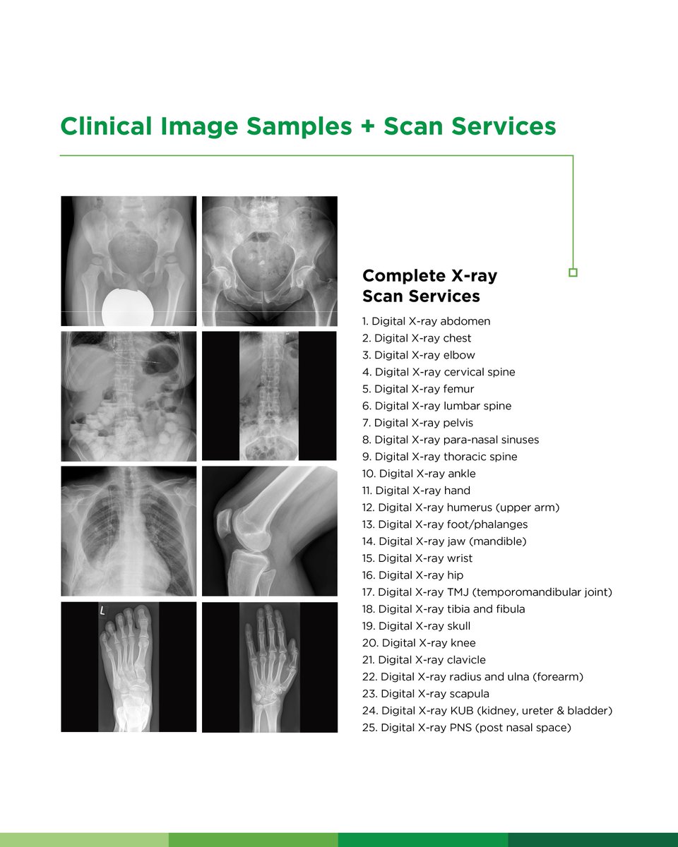 healthtechgh's tweet photo. Looking for reliable X-ray services?

Get fast, high-resolution imaging with an efficient workflow designed to support timely diagnosis.

X-ray scans are performed 24/7, with results typically available within 4 hours.

Visit the Radiology Department at 37 Military Hospital, Accra.

The full list of X-ray examinations is available on the flyer.

📞 Call or WhatsApp: +233 25 607 6441 | +233 25 607 6442