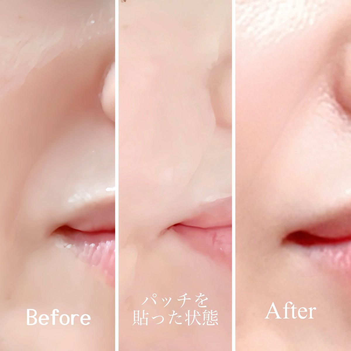 astologymakes's tweet photo. 笑ったあとや鏡を見たとき、気になる口元のライン。

夜のスキンケアに、貼るだけのほうれい線ケアをプラス🌙
レチナール配合パッチが口元にぴたっとフィット。

塗るより手軽だから、毎日のケアに取り入れやすい☺️

@onslo_jp

#PR #onslo #23時のほうれい線ケア #ほうれい線ケア #口元ケア #シワ対策 https://t.co/c8JTkzdTFU