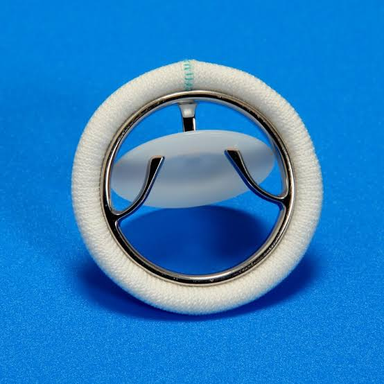 Fintech03's tweet photo. 1 machine whistle-boils rice on an Indian stove; the other snaps shut 40M times a year inside a human ribcage to keep blood from flooding the lungs. This is the silent, terrifying origin story of how India’s most famous kitchenware company quietly took over cardiac surgery.

In the 1970s & 80s, Rheumatic Heart Disease (RHD) was a silent killer across India. Strep throat infections in children, if untreated, triggered autoimmune reactions that deformed the mitral & aortic heart valves. By their 20s, young men & women were dying of heart failure simply because their natural valves could no longer open / close properly.

The medical cure existed: replacing the damaged natural valve with a tilting-disc mechanical heart valve.

The economic reality was brutal: imported valves from Western manufacturers cost upwards of ₹55K, equivalent to yrs of salary for an average Indian household. 

1000s of patients were left to die simply because of a price tag.

Dr. M.S. Valiathan, a brilliant cardiac surgeon trained at Johns Hopkins & Liverpool comes into the scene. In 1974, he took over as founding director of the Sree Chitra Tirunal Institute for Medical Sciences & Technology (SCTIMST) in Trivandrum. He vowed to build a fully indigenous, world-class mechanical heart valve at a fraction of the cost.

The team built a prototype using a single-crystal sapphire disc held in a metallic cage. During fatigue testing in custom pulsatile flow rigs, the sapphire disc suddenly shattered. If that had happened inside a human body, it would mean instant death. Back to the drawing board.

The team engineered a novel free-floating, plano-convex tilting disc made of Ultra-High-Molecular-Weight Polyethylene (UHMW-PE) housed inside a polished, integrally-machined metallic cage.

Because the disc rotates on its own axis as blood surges through, it continuously distributes wear evenly across its surface, giving it a theoretical lifespan of 50+ yrs (validated over 350M accelerated pulse cycles).

By 1989, the valve had passed extreme hydrodynamic testing, toxicological screening & animal trials in sheep. It was ready for human production.

Dr. Valiathan approached major Indian pharmaceutical & engineering conglomerates to license & manufacture the valve. They all said NO.

The corporate fear was simple: Product liability. If a machine tool / an engine part fails, a company loses money; if an artificial heart valve fails inside a patient's chest, you face catastrophic lawsuits & moral ruin.

That was when the TTK Group stepped forward.

TTK is known for Prestige pressure cookers, Skore products, or Fryums, but their leadership saw Dr. Valiathan's vision not as a high-risk liability, but as a moral duty. Using their expertise in high-precision metallurgy, micro-machining & quality control (originally built around pressure-vessel safety valves & seals), TTK established a dedicated, cleanroom medical manufacturing unit in Trivandrum.

In Dec 1990, at SCTIMST, Dr. Valiathan stood over an open chest in an operating theater. He implanted the very 1st production-grade TTK-Chitra Heart Valve into a human patient.

The patient survived, thrived & lived a healthy life for decades.

The TTK Chitra Heart Valve was brought to market at ₹12-20K, slashing the cost of open-heart valve replacement by 60%+ & putting life-saving surgery within reach of millions.

In 2001, the team won the National Technology Award for successful commercialization of indigenous technology.

To this day, while kitchen timers chime over Prestige pressure cookers across Indian homes, 200K+ TTK Chitra valves are opening & closing inside human hearts at 70 beats per minute, 100000 times a day, w/o missing a single pulse.
