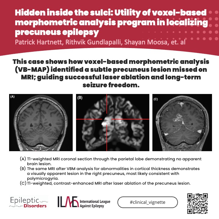 Epileptic Disorders tweet media