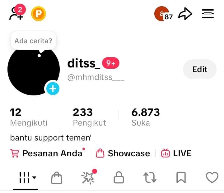 adorsih's tweet photo. WTS ACC TIKTOK F200 +

40k 
 
- bisa affiliate 
- live on 
- like full hasil fyp konten no web
- dapet email di akunnya 
- bebas untuk akun apa saja

#zonauang https://t.co/vyBUhy2sPT