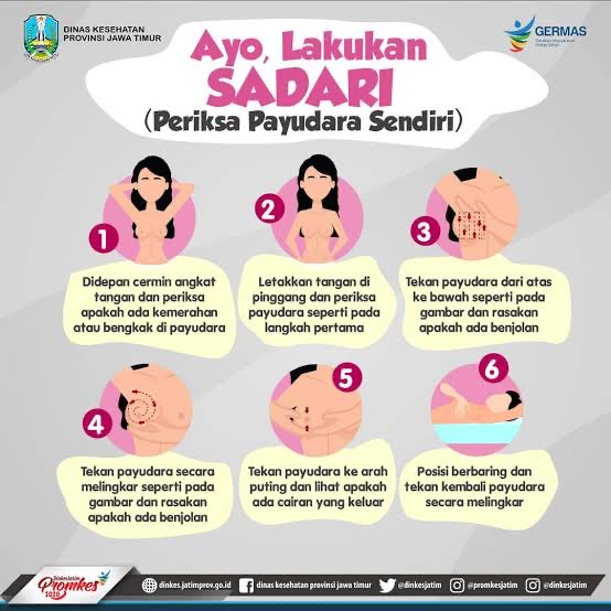 twitnyapimma's tweet photo. kapan hari kedatrngan pasien dg keluhan benjolan di payudara kiri. pas kutanya, ternyata benjolannya udh ada sekitar 2 tahunan. tp krn dikira bakal ilang sendiri atau cuma kelenjeren biasa, akhirnya ga pernah diperiksain.

pas aku cek, benjolannya udh lumayan gede, padat keras, trs ada penarikan di bagian puting. nyeri? engga. cuma udh mulai kerasa ganggu, dan kdg kaya gatel gt.

akhirnya diarahkn buat usg + fnab, dan hasilnya mengarah ke keganasan (kanker payudara).

please ya temen2, jgn nunggu sakit dulu baru periksa. krn kanker payudara di awal seringnya emg ga nyeri. yuk biasain sadari tiap bulan. kalo ngerasa ada benjolan yg ga ilang2, perubahan bentuk payudara, puting ketarik ke dalem, atau ada perubahan lain yg bikin curiga, langsung periksa ya.

kalo pake bpjs, bisa minta surat rujukan dulu dr faskes 1. kalo umum, tinggal langsung ke rs (poli bedah ya).