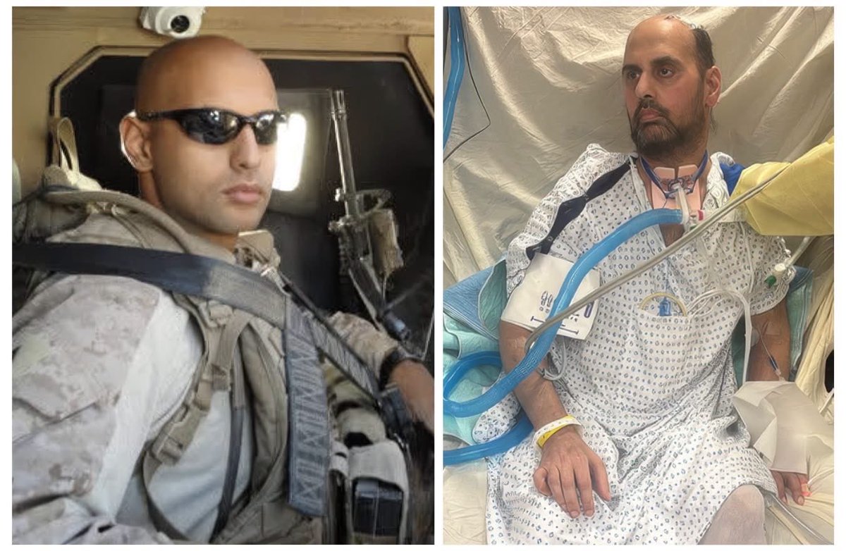 boonecutler's tweet photo. PLEASE HELP US GET ANTHONY A SECOND OPINION.

1/6 Marine Regiment veteran Rob Chilelli reached out to us this past week, praying someone can help get his brother, Anthony Chilelli, the life-saving care he needs.

Anthony is also a Marine who served our country in 3/1 Marine Regiment from 2007–2012, bravely fighting in Garmsir, Afghanistan, before continuing service as an NYPD officer.

On February 19, 2026, Anthony went into the hospital for brain surgery to remove a rare tumor near his pituitary gland.

What followed was months of devastating complications — significant bleeding in his brain, another emergency surgery, a stroke, brain swelling requiring part of his skull to be removed, persistent hydrocephalus and problems with the fluid surrounding his brain, seizures, and a prolonged state of severely impaired consciousness... going on for six months at Staten Island University Hospital, and his family is requesting a transfer.

His wife, Dianna, was in her third trimester of pregnancy when their lives changed overnight.

There are parts of Anthony's hospitalization that our family has very serious questions about, and those questions will eventually need answers. But right now, this isn't about blame. This is about Anthony.

We need another set of eyes on him, assuring nothing has been overlooked.

We are desperately trying to get Anthony's case reviewed by a tertiary academic Neuro-ICU and neurosurgical team at Columbia/NewYork-Presbyterian, Weill Cornell, NYU Langone, or another major neurological center capable of managing an extraordinarily complicated case like his.

Anthony cannot advocate for himself right now.

So we are going to advocate as loudly as we possibly can for him.

He's a husband, brother, a son and he is a father whose children need him.

And we are not ready to accept that there is nothing else to be done until an independent team of experts has looked at every scan, every record, every complication and every possible option.

𝗣𝗟𝗘𝗔𝗦𝗘 𝗦𝗛𝗔𝗥𝗘 𝗧𝗛𝗜𝗦
Please help us get Anthony's case in front of the right people.

We're asking for a door to open.

Help us get Anthony a transfer to NewYork-Presbyterian Hospital -Columbia/Weill Cornell for an independent second opinion. Help us get this Marine in front of another team, giving him a chance at life.

https://t.co/B5NzbaokdB