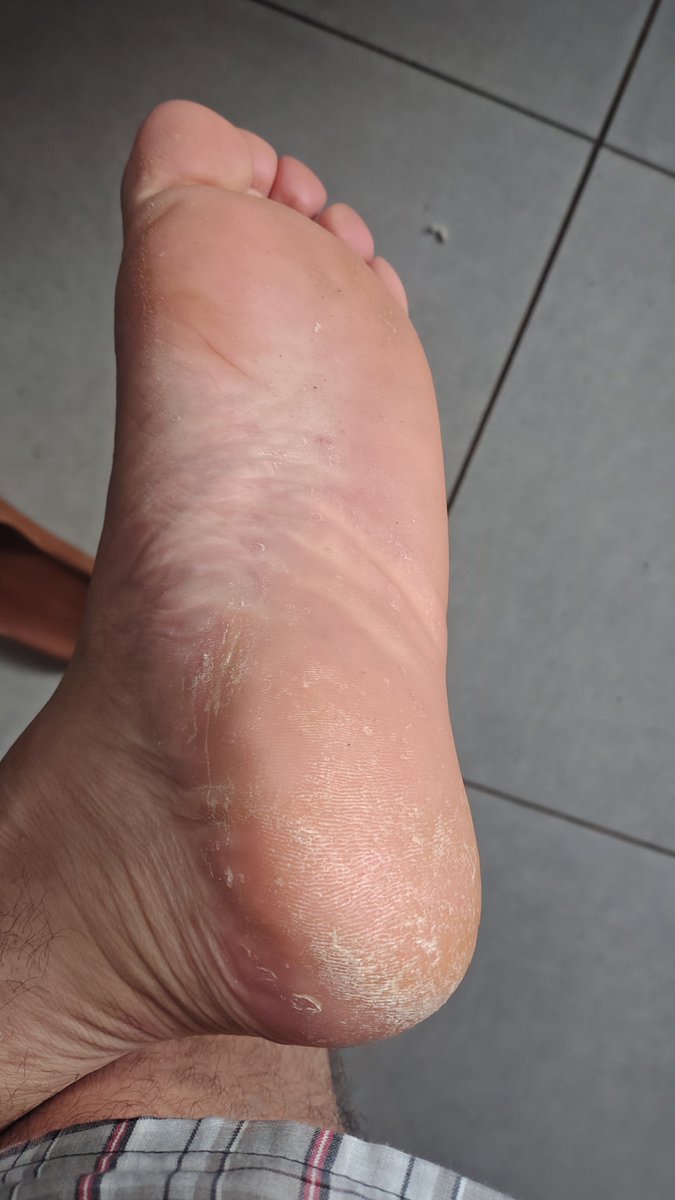 FindomHypnotic's tweet photo. A sola que você tanto deseja
#feetfetısh #feetworshi̇p #masterfeet https://t.co/u4UoAnx9lD