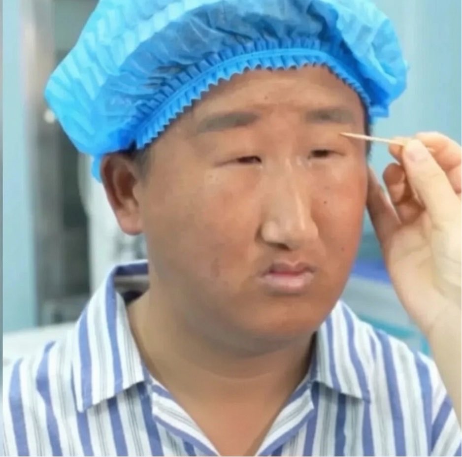 ceolmh3's tweet photo. 성형수술 Before &amp; After 전설로 남은 중국 남성 https://t.co/05l4qDtDA1