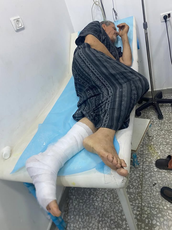 Timesofgaza's tweet photo. Israeli settlers assaulted farmer Issam Radwan and his wife while they were at their farm in the village of Beitillu, west of Ramallah. https://t.co/4d7tSaxSGL