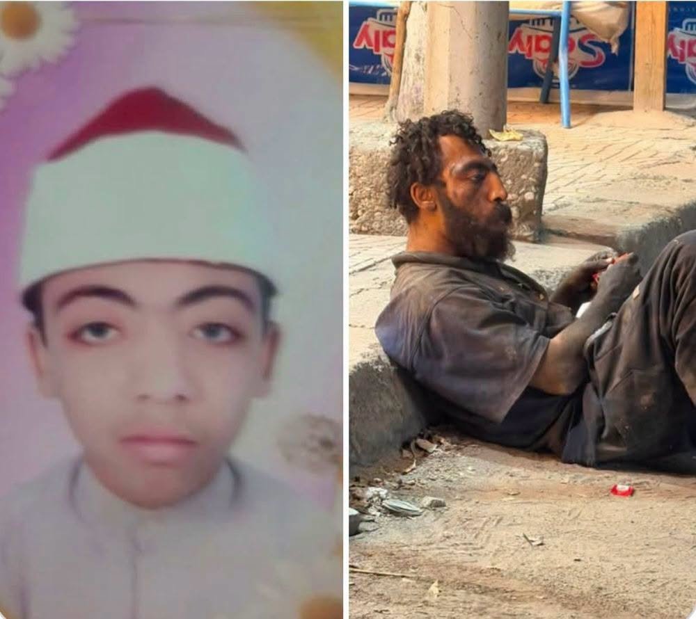 AhmadX_Official's tweet photo. There is a reason the Day of Judgment must come.

The story of a young Egyptian named Mahmoud has shaken countless hearts. Once a student of Islamic law with dreams, ambitions, and a future ahead of him, he has spent the last four years wandering the streets of Helwan in Cairo, mentally broken and unable to care for himself.

According to local accounts, everything changed after a bitter inheritance dispute following his father's death. Mahmoud was allegedly deprived of his rightful share, and the emotional trauma left him battling severe mental illness.

After videos of him spread online, volunteers and community members began searching for his identity. They traced his roots to Sohag and identified relatives in Aswan. Their goal is not to shame anyone, but to obtain the documents needed to move Mahmoud into a care facility where he can receive treatment, dignity, and protection.

Stories like this remind us how easily wealth, property, and worldly gain can make people forget justice, compassion, and even family ties. Money remains behind, but the cries of the oppressed are never ignored by Allah.

This is why belief in the Day of Judgment matters. If a wrongdoer escapes justice in this world, if the vulnerable are denied their rights, and if the oppressed never find justice on earth, then there must be a Day when every soul is held accountable, every injustice is addressed, and every right is restored.

The Prophet Muhammad PBUH said:

"Beware of oppression, for oppression will become darkness on the Day of Resurrection." (Sahih Muslim 2578)

He also said:

"Whoever has wronged his brother should seek his forgiveness today, before the Day when there will be neither gold nor silver. If he has good deeds, they will be taken from him and given to the one he wronged. If he has no good deeds left, the sins of the oppressed will be placed upon him." (Sahih al-Bukhari 2449)