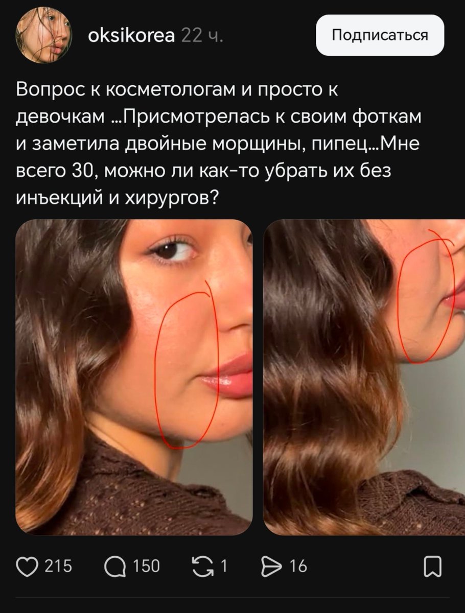 TrapOfNerves's tweet photo. сука да как люди доживают до своих лет https://t.co/Lr95D3UwZ9