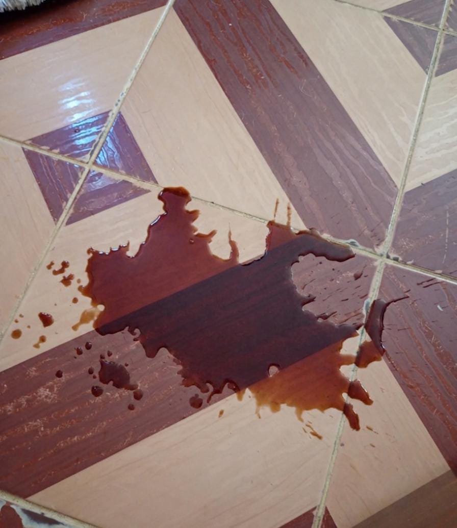 thaiannax's tweet photo. Oi gente, infelizmente o estado da Cacau está piorando a cada dia. Hoje ela vomitou  escuro e com um cheiro muito forte e horrível.n sei mais como proceder..  Ela já vem enfrentando tantos problemas de saúde e, mesmo com todo o nosso esforço, a situação está ficando cada vez mais difícil.
A Cacau precisa de atendimento, exames, medicamentos e alimentação adequada, mas a ajuda tem sido muito pouca. Sem apoio, não estamos conseguindo dar a ela tudo o que precisa nesse momento tão delicado. Por favor, não ignorem a Cacau. Qualquer valor, mesmo R$5 ou R$10, pode fazer diferença. Quem não puder doar, compartilhe essa publicação para que ela alcance mais pessoas. Pois ultimamente as pessoas só tem aparecido pra julgar ou falar besteiras, não se dão nem ao trabalho de entrar no perfil e ver os exames e a história dela. Pf, quem puder ajudar..
Pix CPF 149.983.397-02