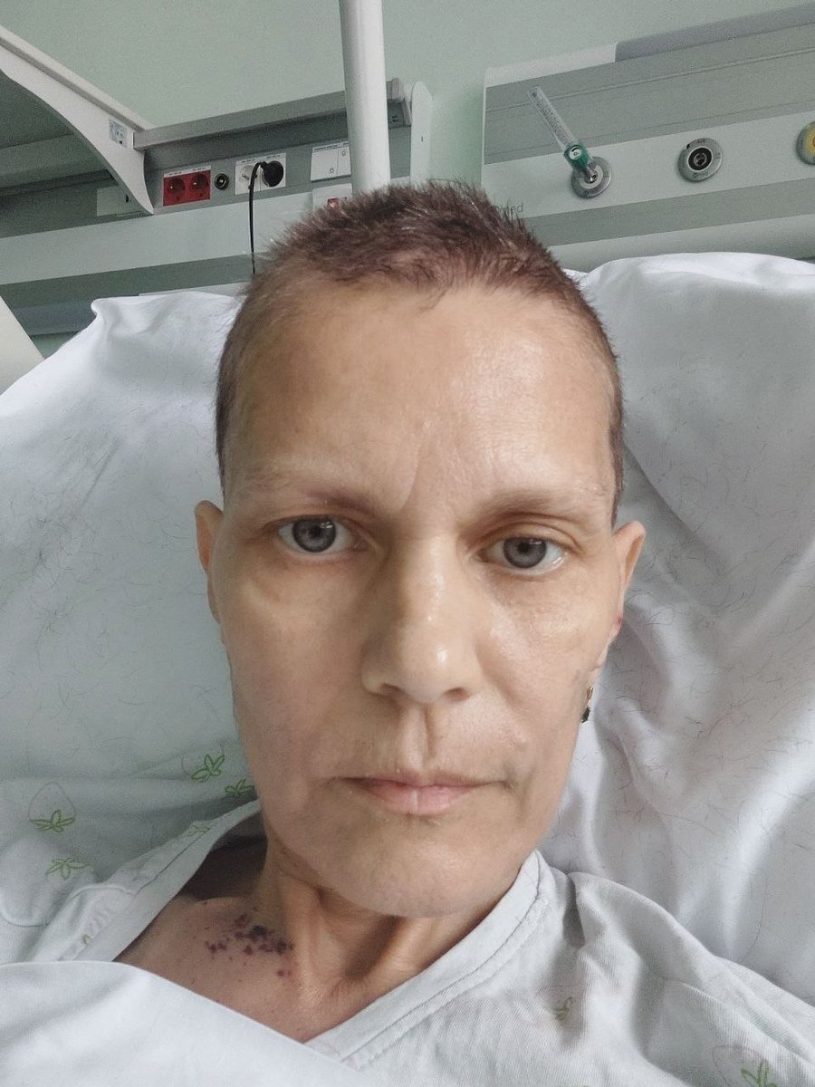 Med0edka's tweet photo. Всем привет. Меня зовут Надежда Нырцова. У меня рак 4 степени и недавно я чуть не умерла. Обращаюсь с огромной просьбой закрыть задолженность по квартире за три месяца в сумме 9800 злотых. В больнице я выглядела так как на фото, а второе фото исколотых пальцев проверка сахара.🥺 https://t.co/hKy8vameJK