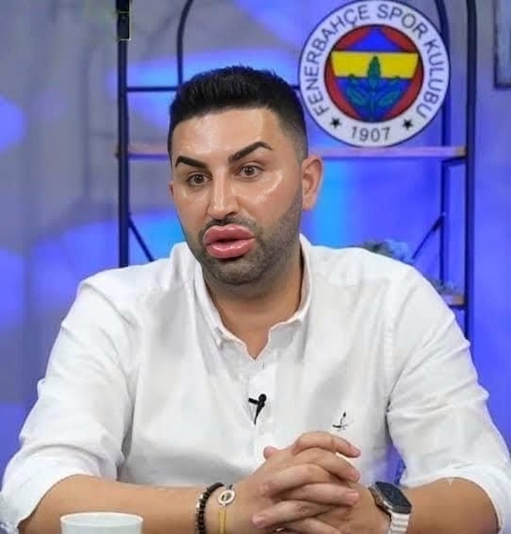 Errugan's tweet photo. @KramponSport Botokscan sen şu tipinle Aziz yıldırım'a hesap mı soruyosun 😅olum seni zenne yapar boğa meydanda oynatırlar bak haberin olsun https://t.co/KOJxjzY91f