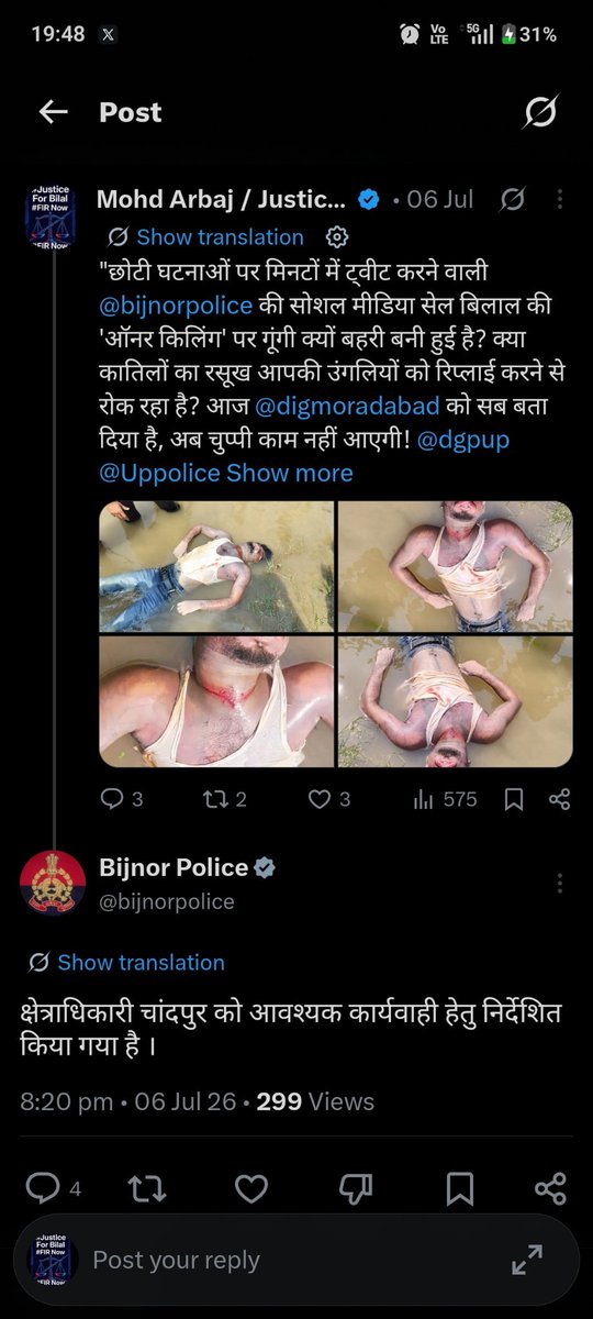 MohdArb19221129's tweet photo. रात ढल चुकी है, लेकिन बिलाल की लाश अभी भी चीख रही है।

गले पर strangulation के निशान, चेहरे पर सूजन, शरीर पर बर्बर चोटें — सबूत साफ हैं,
फिर भी बिजनौर पुलिस ने झूठी रिपोर्ट बनाकर केस दबा दिया।

SHO शिवाला कलां और उसके साथी अफसरों ने रसूख वाले आरोपी को बचाने के लिए परिवार को दर-दर भटकाया, माँ के आंसू पोंछने से इनकार किया, सबूत नष्ट होने दिया।

43+ दिन हो गए, FIR तक नहीं।
ये पुलिस नहीं, हत्यारों की ढाल बन चुकी है।
अब और सहन नहीं होगा।

जनता देख रही है।
@bijnorpolice @Uppolice @CMOfficeUP @digmoradabad
#JusticeForBilal #BijnorPoliceExposed #PoliceBetrayal