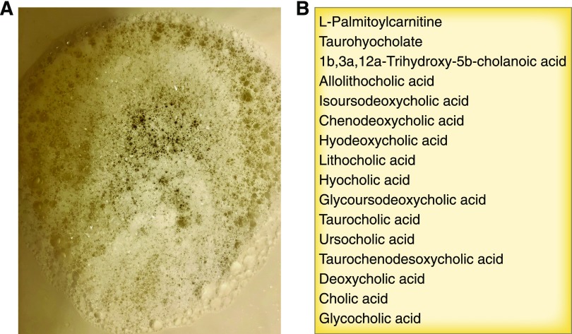 Outdoctrination's tweet photo. Foamy urine - a sign of impaired gut health.

Your urine should be very light and foamless, like water.

The urine can contain multiple soap like substances, most of these are bile acids from the gut.

Bacterial overgrowth in the gut can transform bile acids in the small intestine, damaging the gut lining.

This leads to leakage of bile acids across the gut barrier into the bloodstream.

The kidneys then filter out the excess bile acids into the urine.

You get foamy urine.

This can be due to other causes like proteinurea as well but this is far more common in my experience.