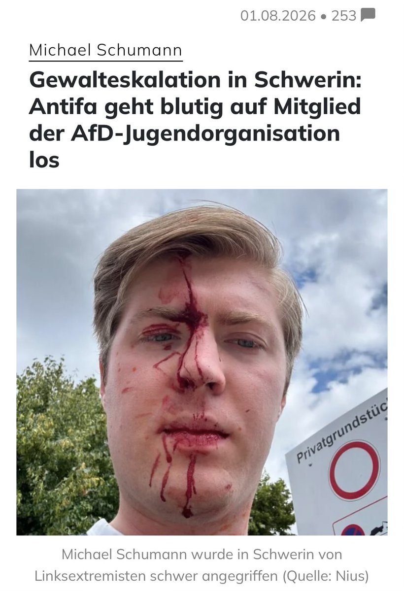 queru_lant's tweet photo. Ist euch schon aufgefallen, dass die Linken verzweifelt versuchen, hier auf X alle Bilder und Videos vom brutalen Antifa-Angriff auf AfD-Politiker Michael Schumann zensieren zu lassen?

Solche "unschönen" Bilder möchten sie vor den Wahlen in Ostdeutschland nicht haben.

@elonmusk https://t.co/HEJDNHgGkm