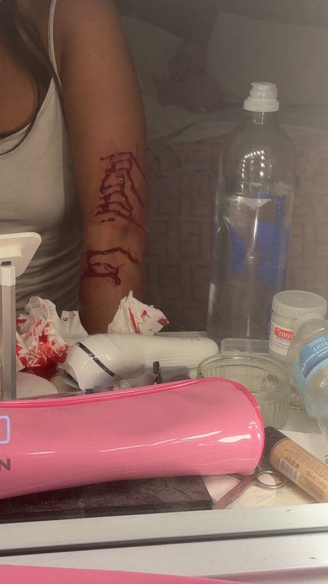user221604's tweet photo. ALL FAKE!!!! SFX MAKEUP https://t.co/9TN0RFAquu