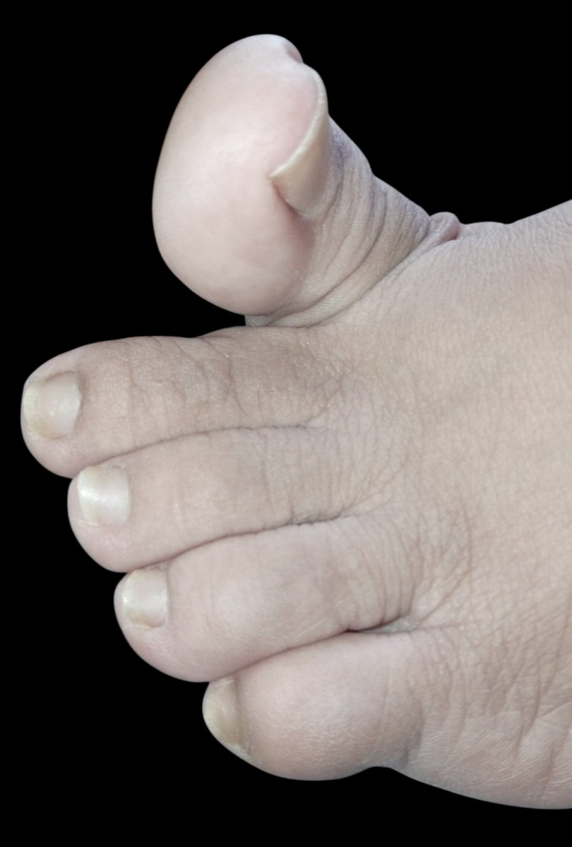carminafeet12's tweet photo. Mis 👣 en modo limpieza de casa 🤭🥰 #pies #piessudados #olor #oloraqueso #piesudados #dedos #dedogordo #deditos #footfetısh #feetfetısh #natural #foot #closeup #soles #plantadelospies #plantas #arrugas #dedosapretados #fetiche #fetichedepies #uñas #fetish https://t.co/MI4fm4nsQ6