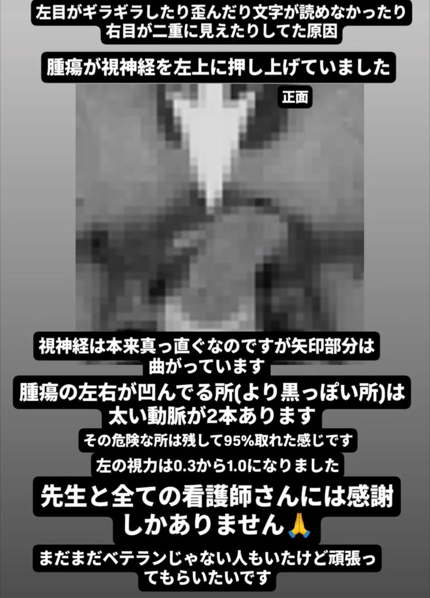 knight_Rider259's tweet photo. 術後9日目なのでまだまだ初期型アコードに乗れませんが #CY2 のアップデートは皆さん完了ですか？ https://t.co/OPnJbR9FDJ