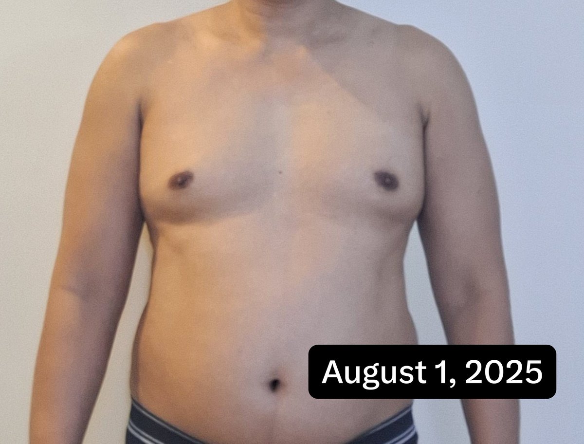 RogersKurt6244's tweet photo. One year ago, I got back in the gym.
Today, my blood pressure is normal, and I have my body back from 20 years ago.
The biggest lesson? Just keep showing up. Consistency really does pay off. πͺ
#FitnessJourney #Consistency #HealthyAging https://t.co/FHpQUNQbcK
