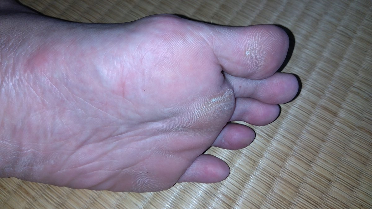 Xo4n3's tweet photo. 今日の扁平足👣
アップだとシワと角質が凄いw
​#男の足裏 #足裏 #素足 #蒸れ足 #扁平足 #ゲイ #GayFeet #MaleFeet https://t.co/rdsggc0H8P
