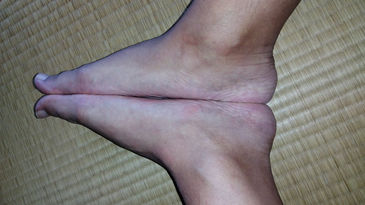 Xo4n3's tweet photo. 今日の扁平足👣
アップだとシワと角質が凄いw
​#男の足裏 #足裏 #素足 #蒸れ足 #扁平足 #ゲイ #GayFeet #MaleFeet https://t.co/rdsggc0H8P