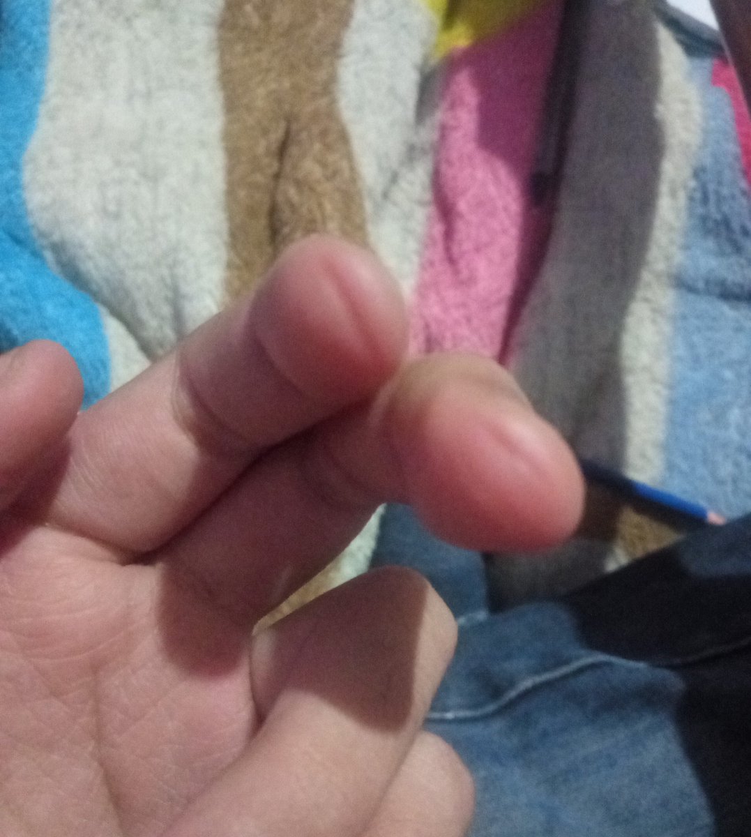 tianaa888's tweet photo. Mis dedos no aguantan,tocar guitarra me hace mierda pero bn. (⁠〒⁠﹏⁠〒⁠) https://t.co/IKdEZ2zq6u