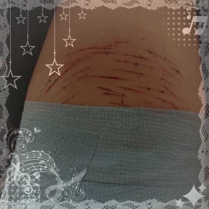 Tavernhvrm's tweet photo. Proxy symbol (creepypasta) SFX makeup from a few weeks ago! My new prosthetics!! #shtw #slittw #988tw #sfx #fakeprosthetic https://t.co/05AHC5rEGE