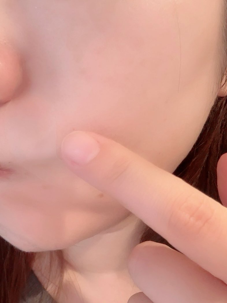 shion_ripple's tweet photo. 写真を撮るたびに口元のラインが気になる…そんな日は、寝る前に貼るだけの「onslo レチナールほうれい線パッチ」を愛用中✨ 密着感がよく、ナイトケアに取り入れやすい♪ #onslo #23時のほうれい線ケア #ほうれい線ケア #口元ケア #シワ対策 #PR https://t.co/2O8Pwkxk6H