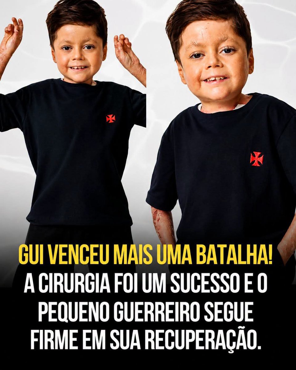 ONOSSOVASCO1's tweet photo. 💢 O coração da torcida vascaína está em festa!

A notícia que todos esperavam finalmente chegou: Gui venceu mais uma batalha! 🙏❤️

A 10ª cirurgia de dilatação do esôfago foi realizada com sucesso, representando mais um passo importante em uma história de coragem, fé e superação que emociona toda a família vascaína.

Agora começa uma nova etapa: a recuperação. Que Deus continue abençoando cada dia dessa caminhada, dando força ao Gui e à sua família até a vitória completa.

O pequeno gigante nos mostra que a verdadeira grandeza está na coragem de nunca desistir. Sua luta inspira milhares de pessoas dentro e fora da torcida do Vasco.

Seguimos em oração por você, campeão! Estamos juntos nessa caminhada. 💢🙏

Força, Gui! A torcida vascaína está com você! ❤️💢