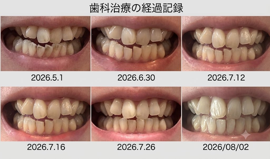 ojine_inv's tweet photo. 上の歯が変化無さすぎる https://t.co/QDoLmCbA0x