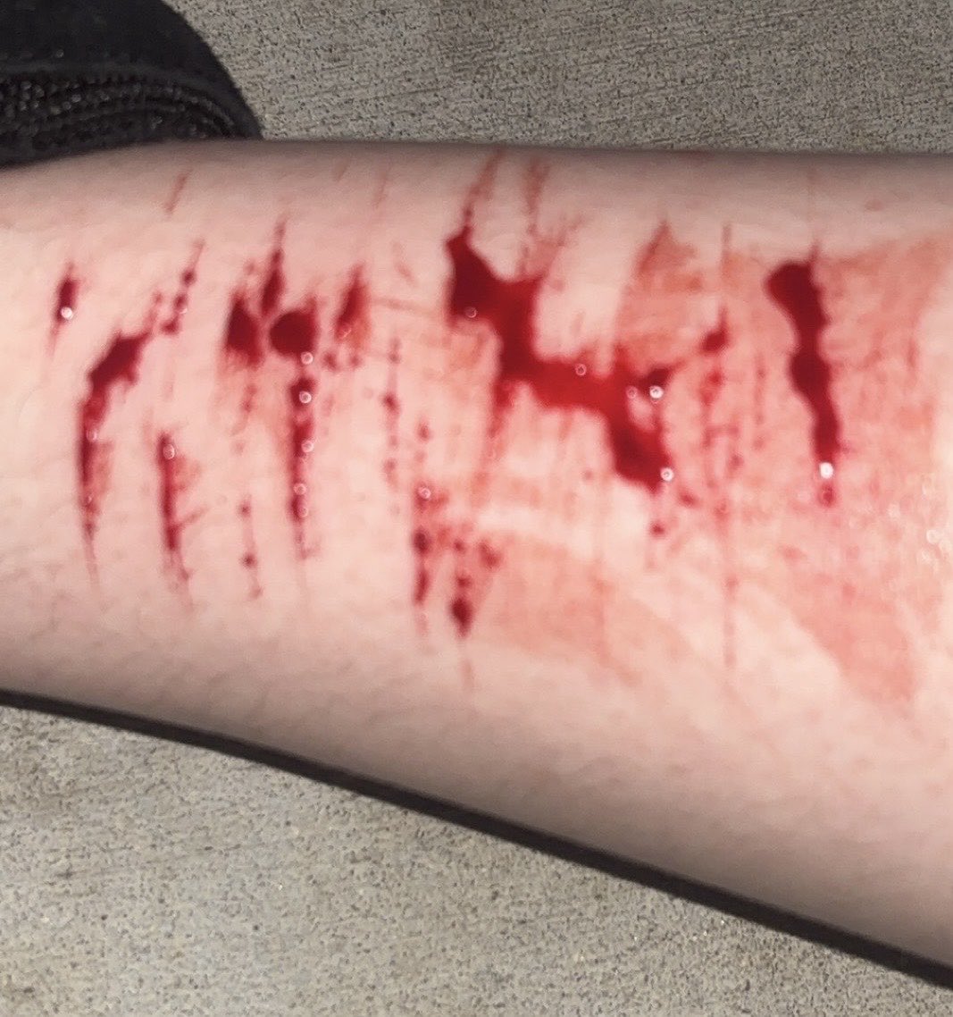 starvingvessel's tweet photo. baby cuts i did outside at midnight 😋 https://t.co/iW5X6VF6qp