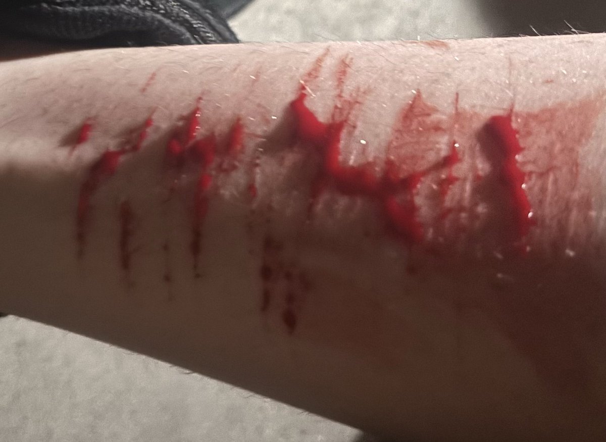 starvingvessel's tweet photo. baby cuts i did outside at midnight 😋 https://t.co/iW5X6VF6qp