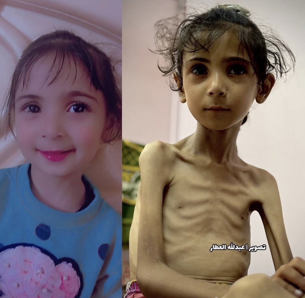 ghadaa231's tweet photo. If u see this pretty angel, reply with 💔🇵🇸 Pray for her.💔 https://t.co/fHso7iuigT