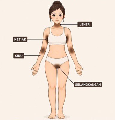 stelobeliy's tweet photo. gileee formulanya niat banget 😮‍💨👏
yang gelap jadi glowing, yang kusam jadi cerah,PD ku sekarang level sultan 😌💅 https://t.co/AhnxLFzoMY