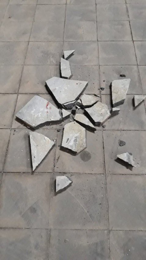 8lampardd's tweet photo. Şanlıurfa’da pediatrideki asistan doktorun kafasında parke taşı kırılmıştı. https://t.co/f7vJ2qwU2f