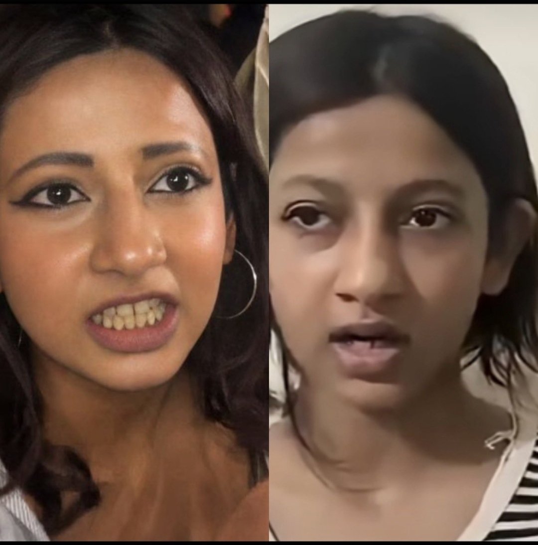 PoornimaNimo's tweet photo. Within a span of 15 days, Ruchika Singh shortened her hair, developed a gap between her lower teeth, shortened her forehead, and developed different eyebrows.

Voila !!! https://t.co/koqCEAFEqh
